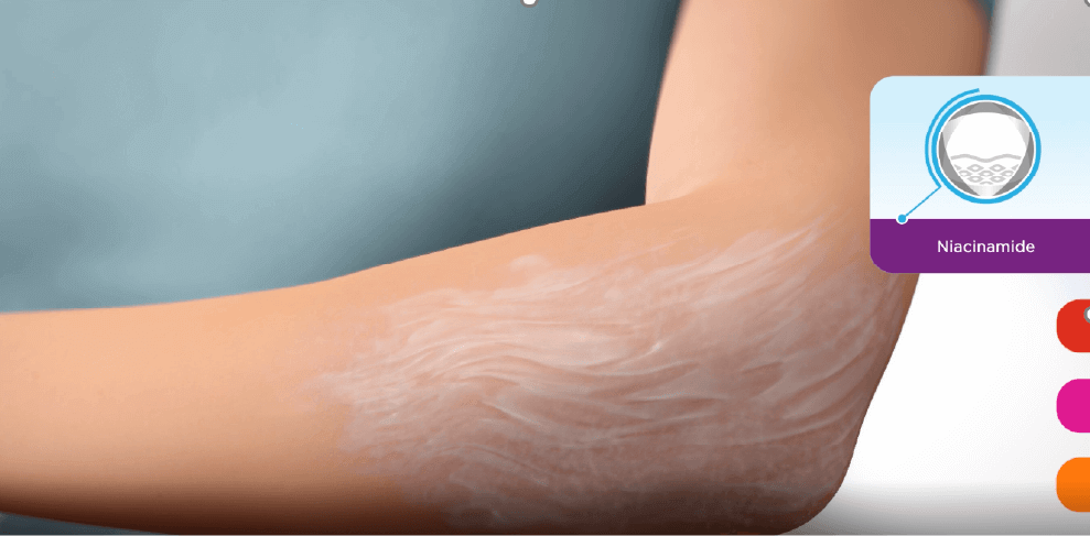 Applying Niacinamide