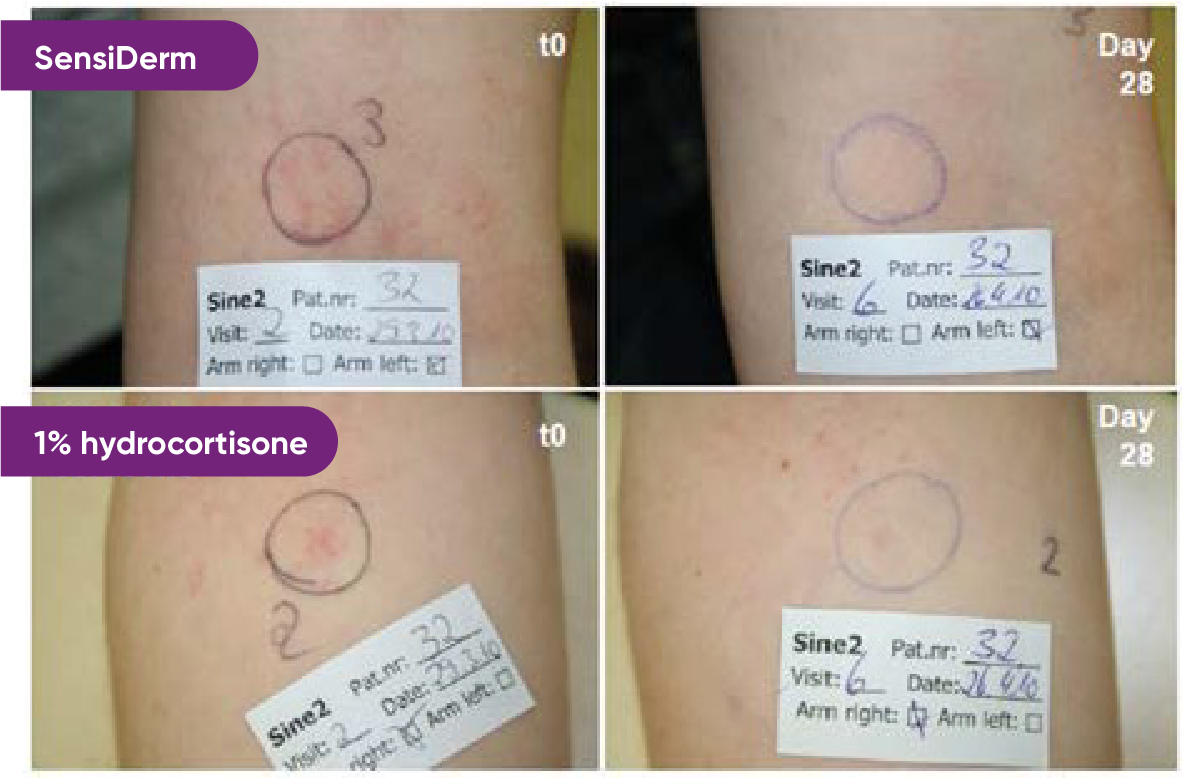 Before and after images