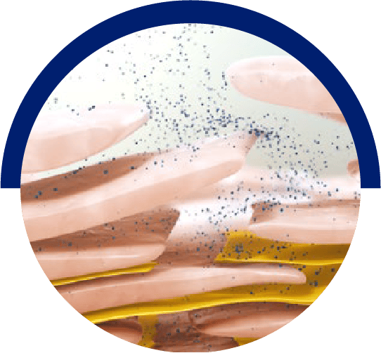 Disturbed epidermal differentiation