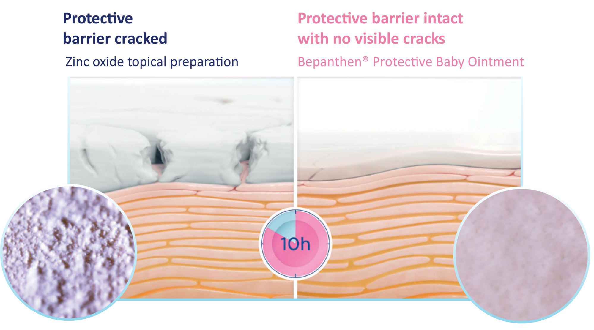 Zinc oxide vs Bepanthen® Baby Ointment