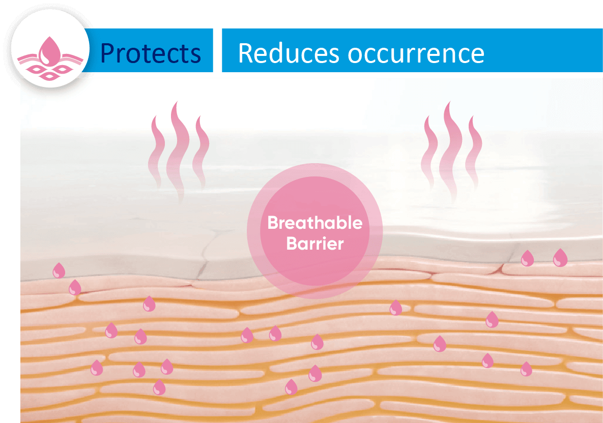 Breathable Barrier
